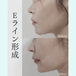 L‘amour clinic Tokyo【ラムールクリニック東京】の症例