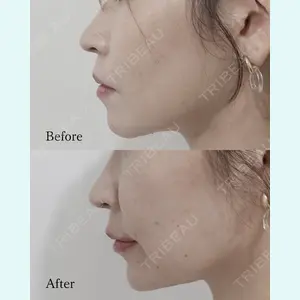 L‘amour clinic Tokyo【ラムールクリニック東京】の症例