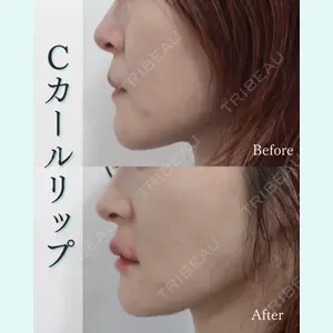 L‘amour clinic Tokyo【ラムールクリニック東京】の症例