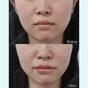 L‘amour clinic Tokyo【ラムールクリニック東京】の症例
