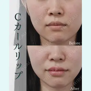 L‘amour clinic Tokyo【ラムールクリニック東京】の症例