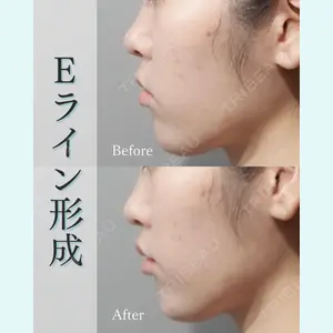 L‘amour clinic Tokyo【ラムールクリニック東京】の症例