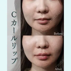 L‘amour clinic Tokyo【ラムールクリニック東京】の症例