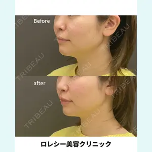 ロレシー美容クリニック 心斎橋駅前院 高田先生医師の症例