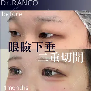症例