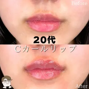ルラ美容クリニック 札幌院 佐藤 雄紀医師の症例