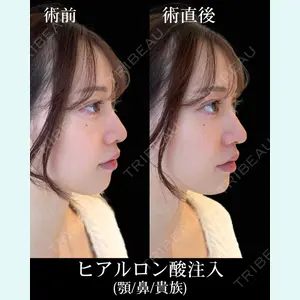 HAAB×DREAM BEAUTY CLINIC 東京本院 佐野 圭医師の症例
