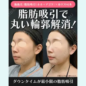 湘南美容クリニック 川崎院 伊藤 賀敏医師の症例