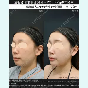 湘南美容クリニック 川崎院 伊藤 賀敏医師の症例
