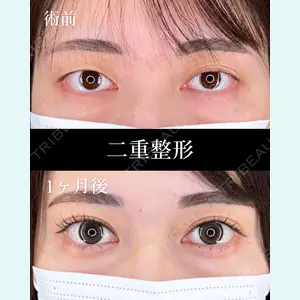 症例