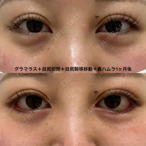 エターナル美容クリニック 久門田 詳医師の症例