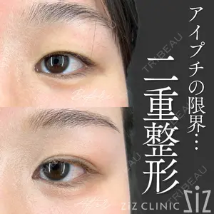 症例