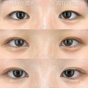 症例