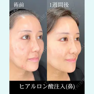 HAAB×DREAM BEAUTY CLINIC 大阪梅田院 錦 実奈医師の症例
