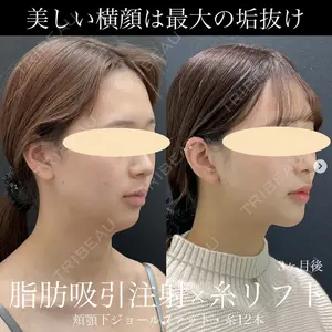湘南美容クリニック 名古屋駅本院 豊嶋 沙良医師の症例
