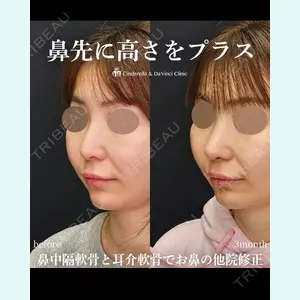 シンデレラ＆ダヴィンチクリニック 宮田 洋佑医師の症例