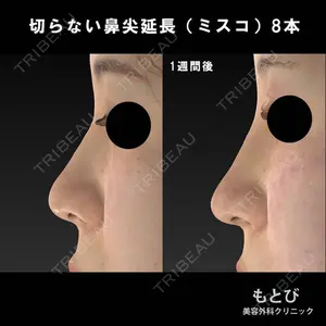 もとび美容外科クリニック 新宿院 西尾 謙三郎医師の症例
