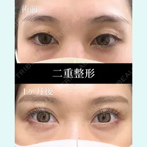症例
