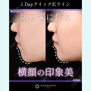症例