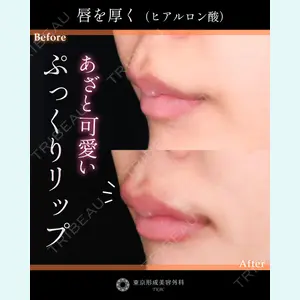 東京形成美容外科 船橋院 山田 大輔医師の症例