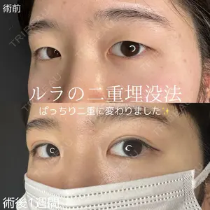 ルラ美容クリニック 仙台院 橋本 英樹医師の症例