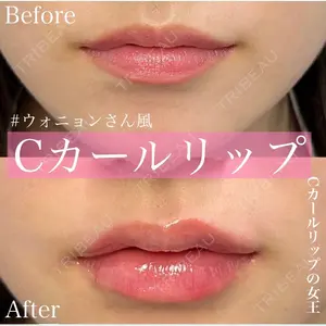 ルラ美容クリニック 渋谷本院 昼間 路子医師の症例