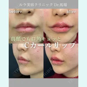 ルラ美容クリニック 名古屋本院 馬場 愛理医師の症例