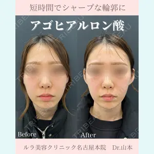 ルラ美容クリニック 名古屋本院 山本 美佳医師の症例