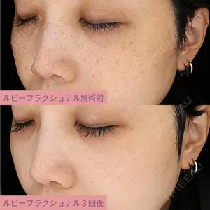 AZ BEAUTY CLINIC 木村 潤医師の症例