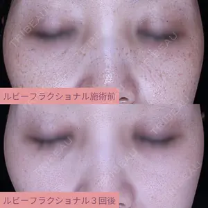 AZ BEAUTY CLINIC 木村 潤医師の症例