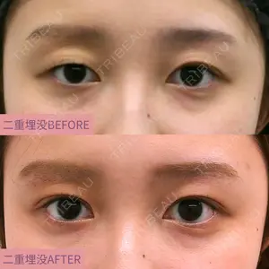 AZ BEAUTY CLINIC 木村 潤医師の症例