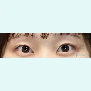症例