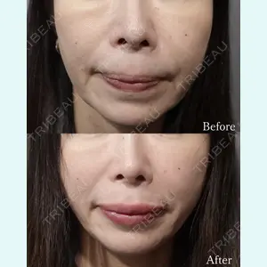 L‘amour clinic Tokyo【ラムールクリニック東京】の症例