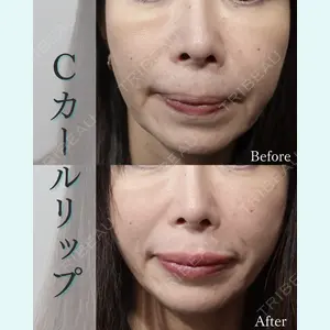L‘amour clinic Tokyo【ラムールクリニック東京】の症例
