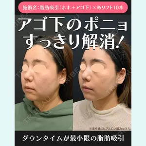 湘南美容クリニック 川崎院 伊藤 賀敏医師の症例