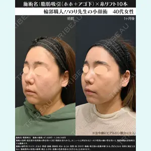 湘南美容クリニック 川崎院 伊藤 賀敏医師の症例