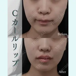 L‘amour clinic Tokyo【ラムールクリニック東京】の症例
