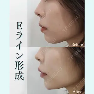 L‘amour clinic Tokyo【ラムールクリニック東京】の症例