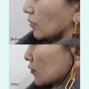 L‘amour clinic Tokyo【ラムールクリニック東京】の症例