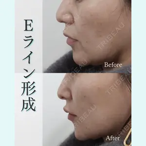 L‘amour clinic Tokyo【ラムールクリニック東京】の症例