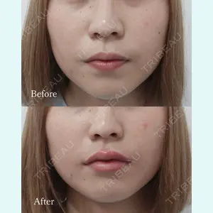 L‘amour clinic Tokyo【ラムールクリニック東京】の症例