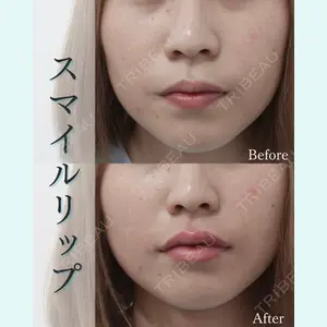 L‘amour clinic Tokyo【ラムールクリニック東京】の症例