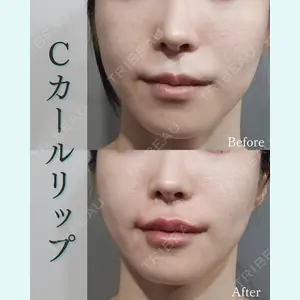 L‘amour clinic Tokyo【ラムールクリニック東京】の症例