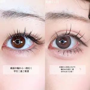 症例