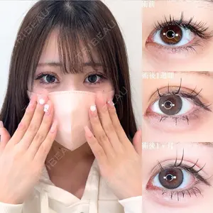 症例