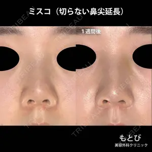 もとび美容外科クリニック 新宿院 西尾 謙三郎医師の症例