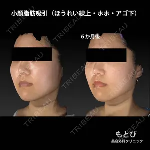 もとび美容外科クリニック 新宿院 西尾 謙三郎医師の症例