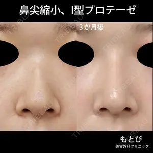 もとび美容外科クリニック 新宿院 西尾 謙三郎医師の症例
