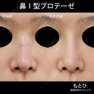 もとび美容外科クリニック 新宿院 西尾 謙三郎医師の症例