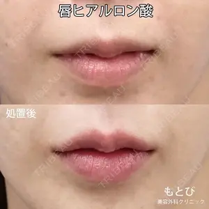 もとび美容外科クリニック 新宿院 西尾 謙三郎医師の症例